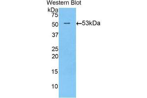 Western Blotting (WB) image for anti-Transglutaminase 1, Keratinocyte (TGM1) (AA 504-737) antibody (ABIN1860737) (TGM1 antibody  (AA 504-737))