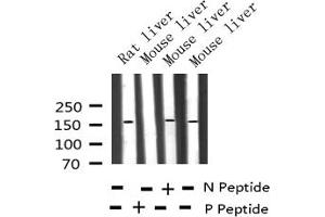 Western blot analysis of Phospho-EGFR (Thr678) expression in various lysates (EGFR antibody  (pThr678))