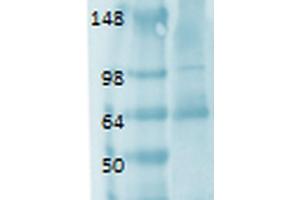 Western Blot analysis of Human thyroid lysate showing detection of Sodium Iodide Symporter protein using Mouse Anti-Sodium Iodide Symporter Monoclonal Antibody, Clone 14F . (SLC5A5 antibody  (AA 468-643) (Atto 390))