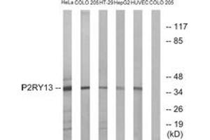 Western blot analysis of extracts from HeLa/COLO/HT-29/HepG2/HuvEc cells, using P2RY13 Antibody.