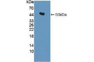 Detection of Recombinant IDH2, Human using Polyclonal Antibody to Isocitrate Dehydrogenase 2, mitochondrial (IDH2) (IDH2 antibody  (AA 40-452))