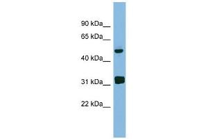 LYAR antibody used at 1 ug/ml to detect target protein. (LYAR antibody)
