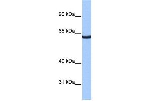 WB Suggested Anti-ZNF350 Antibody Titration:  0.