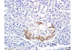 Formalin-fixed and paraffin embedded rat pancreas labeled with Anti-SREBP-1 Polyclonal Antibody, Unconjugated (ABIN686032) followed by conjugation to the secondary antibody and DAB staining (Srebp-1/2 (AA 301-450) antibody)