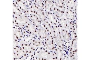 Immunohistochemistry (Paraffin-embedded Sections) (IHC (p)) image for anti-Adrenergic, alpha-1B-, Receptor (ADRA1B) antibody (ABIN7072974)