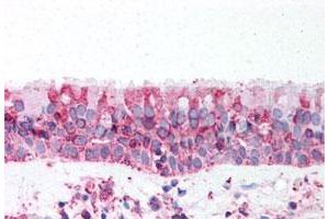 Immunohistochemistry (Formalin/PFA-fixed paraffin-embedded sections) of human trachea tissue with TRPV4 polyclonal antibody . (TRPV4 antibody  (N-Term))