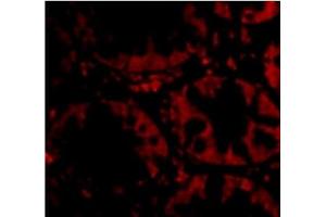 Immunofluorescence of STEAP2 in Human Colon cells with STEAP2 Antibody  at 20 µg/ml. (STEAP2 antibody  (C-Term))