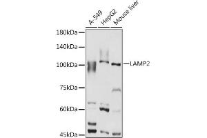 Western blot analysis of extracts of various cell lines, using L antibody (ABIN6129969, ABIN6143081, ABIN6143082 and ABIN6218224) at 1:1000 dilution. (LAMP2 antibody  (AA 30-300))