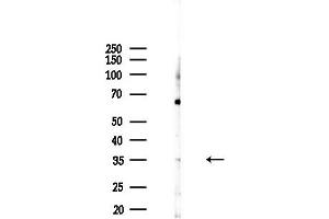 anti-SIX Homeobox 1 (SIX1) (Internal Region) antibody