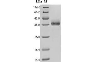 (Tris-Glycine gel) Discontinuous SDS-PAGE (reduced) with 5 % enrichment gel and 15 % separation gel.