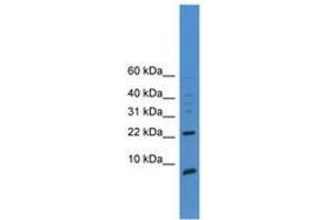 Image no. 1 for anti-Prostate Stem Cell Antigen (PSCA) (AA 51-100) antibody (ABIN6745361) (PSCA antibody  (AA 51-100))