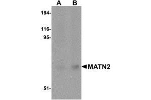 Western Blotting (WB) image for anti-Matrilin 2 (MATN2) (C-Term) antibody (ABIN1030508) (MATN2 antibody  (C-Term))