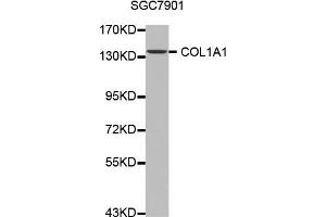 Western blot analysis of extracts of SGC7901 cell line, using COL1A1 antibody. (COL1A1 antibody)