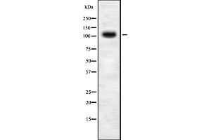 TOPORS antibody  (C-Term)