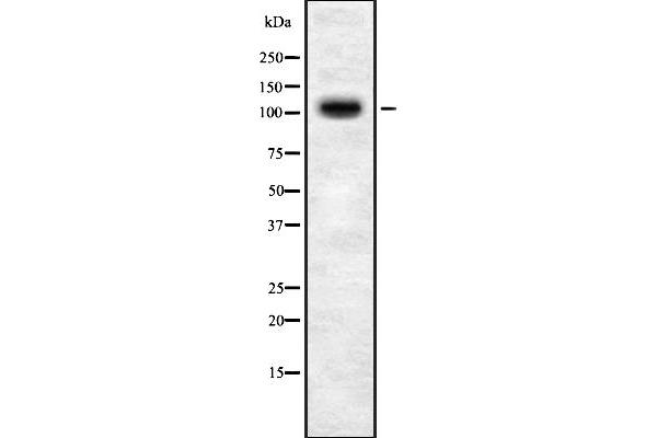 TOPORS antibody  (C-Term)
