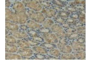 Figure. (ITGAD antibody  (AA 879-1099))