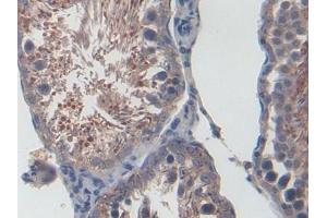 DAB staining on IHC-P; Samples: Rat Testis Tissue (CXCL1 antibody  (AA 25-96))