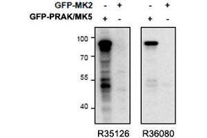 Western blot of HEK293 lysate overexpressing mouse MK5/PRAK (first lane) or mouse MK2 (second lane) tested with right ) PRAK antibody (cat # R36080, 0. (MAPKAP Kinase 5 antibody)