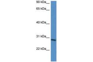 Image no. 1 for anti-BARX Homeobox 2 (BARX2) (AA 65-114) antibody (ABIN6746065) (BARX Homeobox 2 antibody  (AA 65-114))