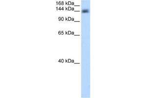 Western Blotting (WB) image for anti-Cleavage and Polyadenylation Specific Factor 1, 160kDa (CPSF1) antibody (ABIN2462246)