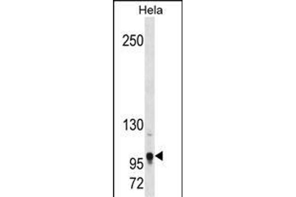 TSHZ1 抗体  (AA 639-665)