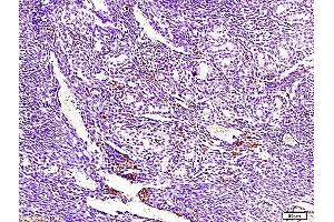 Formalin-fixed and paraffin embedded mouse endometrium tissue labeled with Anti-ECM1 Polyclonal Antibody, Unconjugated  at 1:300, followed by conjugation to the secondary antibody and DAB staining (ECM1 antibody  (AA 488-567))