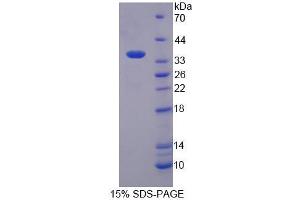 SDS-PAGE analysis of Human EEF1a2 Protein.