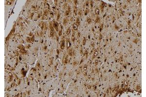 ABIN6275855 at 1/100 staining Human heart tissue by IHC-P. (STK33 antibody  (N-Term))