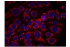 Immunofluorescence staining of methanol-fixed MCF7 cells using CD340 / ERBB2 / HER2 Antibody (pTyr1248) (ErbB2/Her2 antibody  (pTyr1248))