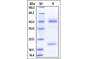Human IL-23 alpha & Mouse IL-12 beta Heterodimer Protein on SDS-PAGE under reducing (R) condition.