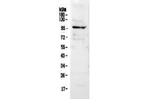 Western blot analysis of NFAT1 using anti-NFAT1 antibody . (NFAT1 antibody  (AA 594-676))