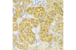 Immunohistochemistry of paraffin-embedded mouse kidney using CBS antibody at dilution of 1:100 (x400 lens). (CBS antibody)