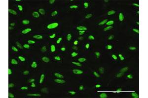 Immunofluorescence (IF) image for anti-X-Ray Repair Complementing Defective Repair in Chinese Hamster Cells 1 (XRCC1) (AA 1-633) antibody (ABIN521423)