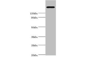 Western blot All lanes: TRPM2 antibody at 2 μg/mL + K562 whole cell lysate Secondary Goat polyclonal to rabbit IgG at 1/10000 dilution Predicted band size: 172, 166, 96 kDa Observed band size: 172 kDa (TRPM2 antibody  (AA 1204-1503))
