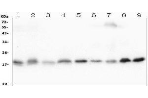 Western blot analysis of Cofilin-2 using anti-Cofilin-2 antibody (ABIN7602747). (Cofilin 2 antibody  (C-Term))