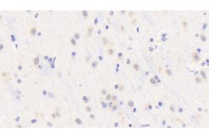 Detection of MyD88 in Rat Cerebrum Tissue using Polyclonal Antibody to Myeloid Differentiation Factor 88 (MyD88) (MYD88 antibody  (AA 1-296))
