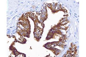 IHC analysis of PAP/ACP3 using anti-PAP/ACP3 antibody (ABIN7600122).