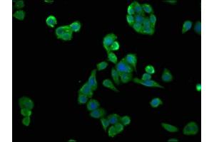 Immunofluorescence staining of PC-3 cells with ABIN7146892 at 1:133, counter-stained with DAPI. (CSNK2A2 antibody  (AA 8-350))