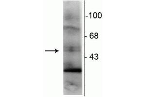 Western blot of rat hippocampal lysate showing specific immunolabeling of the ~48 kDa RXR-γ isotype. (Retinoid X Receptor gamma antibody)