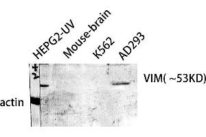 Western Blot (WB) analysis of HepG2-UV Mouse Brain AD293 K562 cells using VIM Polyclonal Antibody. (Vimentin antibody  (C-Term))