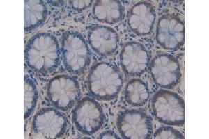 #VALUE! (SFTA2 antibody  (AA 20-78))