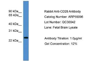 WB Suggested Anti-CD28  Antibody Titration: 0. (CD28 antibody  (C-Term))