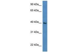 Image no. 1 for anti-Zinc Finger Protein 821 (ZNF821) (N-Term) antibody (ABIN6746166) (ZNF821 antibody  (N-Term))