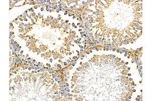 ABIN6259310 and ABIN6274936 at 1/100 staining Rat testis tissue by IHC-P. (PNPLA8 antibody  (C-Term))