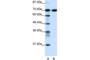 Human Jurkat; WB Suggested Anti-RRN3 Antibody Titration: 0. (RRN3 antibody  (C-Term))