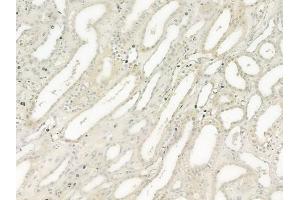 ABIN6259777 and ABIN6277561 at 1/100 staining human normal kidney tissue by IHC-P. (ADAM9 antibody  (C-Term))