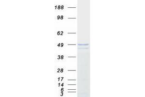 Validation with Western Blot