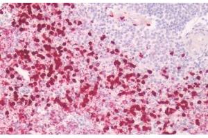 Human Spleen: Formalin-Fixed, Paraffin-Embedded (FFPE) (Prostaglandin E Synthase antibody  (Cytoplasmic Domain))