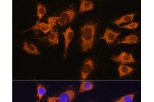 Immunofluorescence analysis of C6 cells using SLC20A1 Polyclonal Antibody at dilution of 1:100. (SLC20A1 antibody)