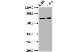 Western Blot Positive WB detected in: K562 whole cell lysate, Rat lung tissue All lanes: POF1B antibody at 3. (POF1B antibody  (AA 532-589))